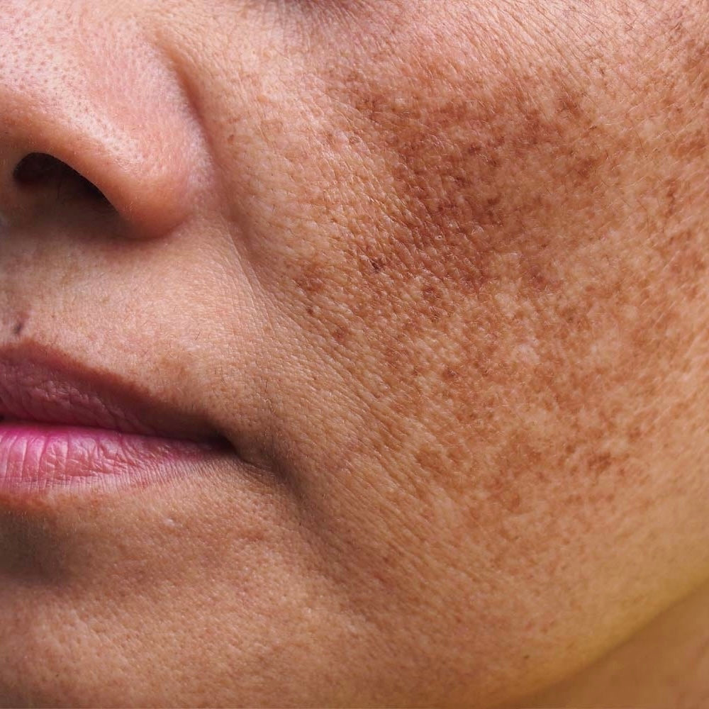 UNEVEN TONE + TEXTURE