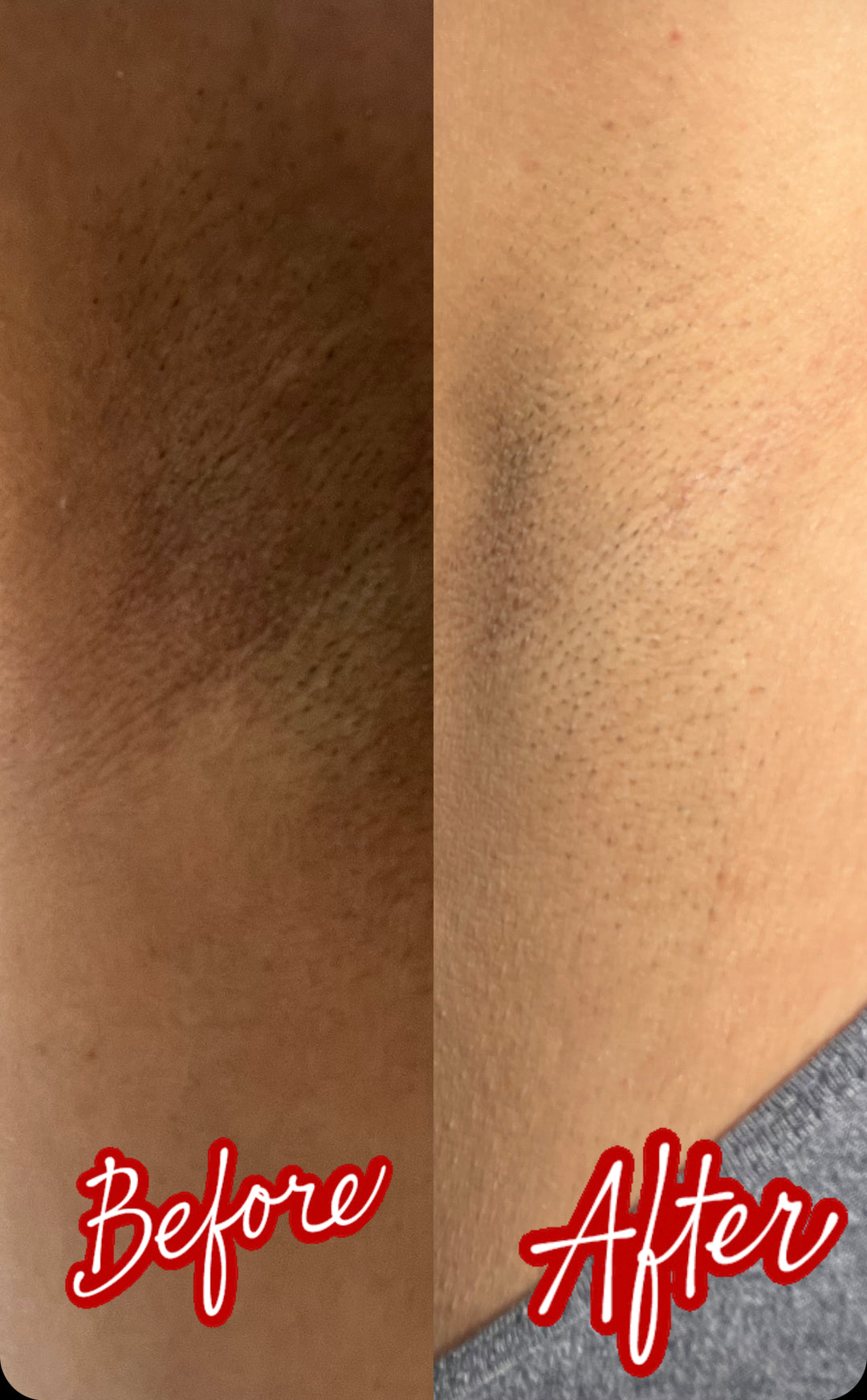 BRIGHTENING KOJIC PAPAYA SOAP