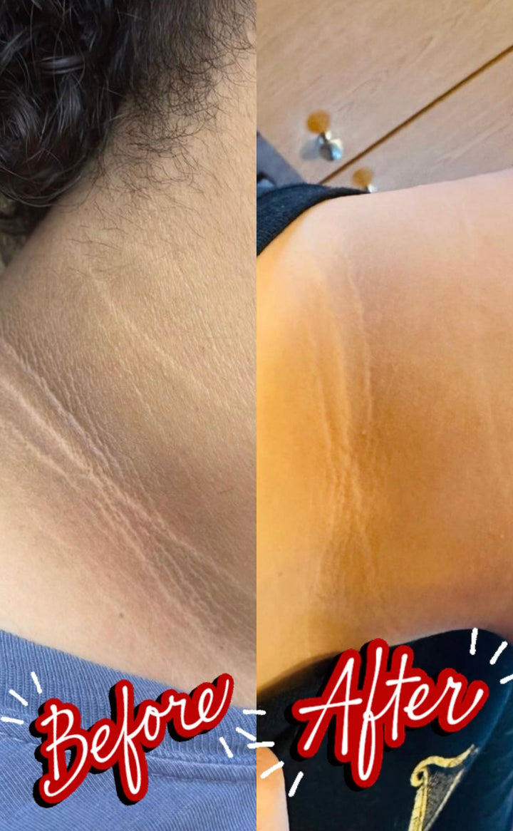 BRIGHTENING KOJIC PAPAYA SOAP